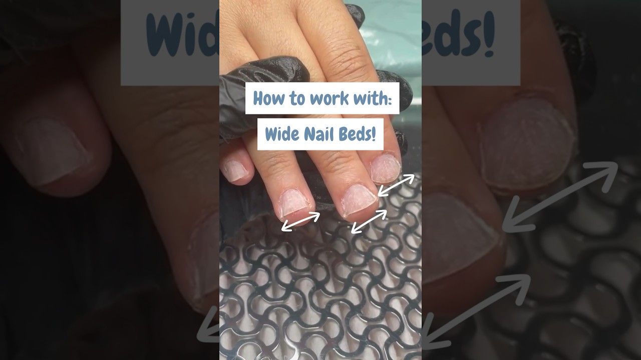 Wide Nail Beds: How to make them smaller! 🫶🏻 #widenailbeds #nailtutorialclips #nailpinching