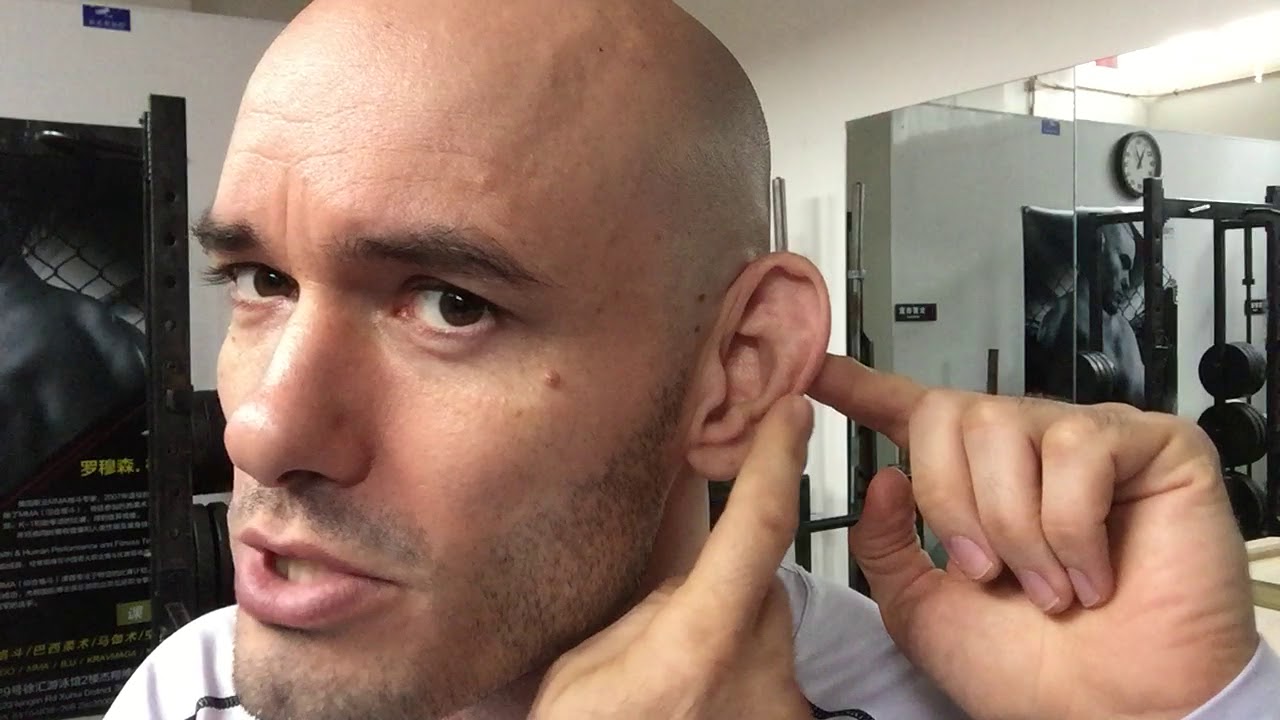 Avoiding Cauliflower Ear?