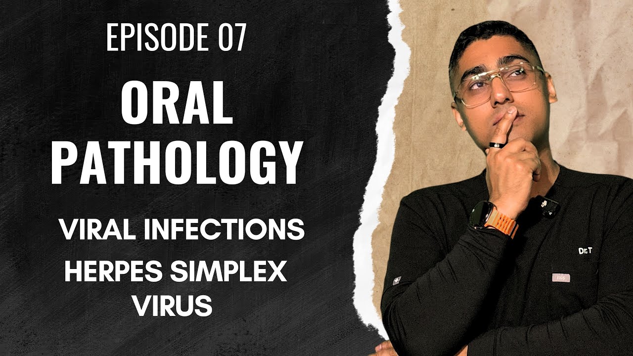 Dental Digest | Oral Pathology | Episode 7 - Herpes Simplex Virus