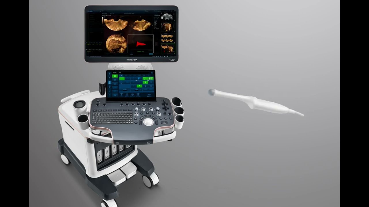 Introduction of Smart ERA on Mindray Nuewa R9