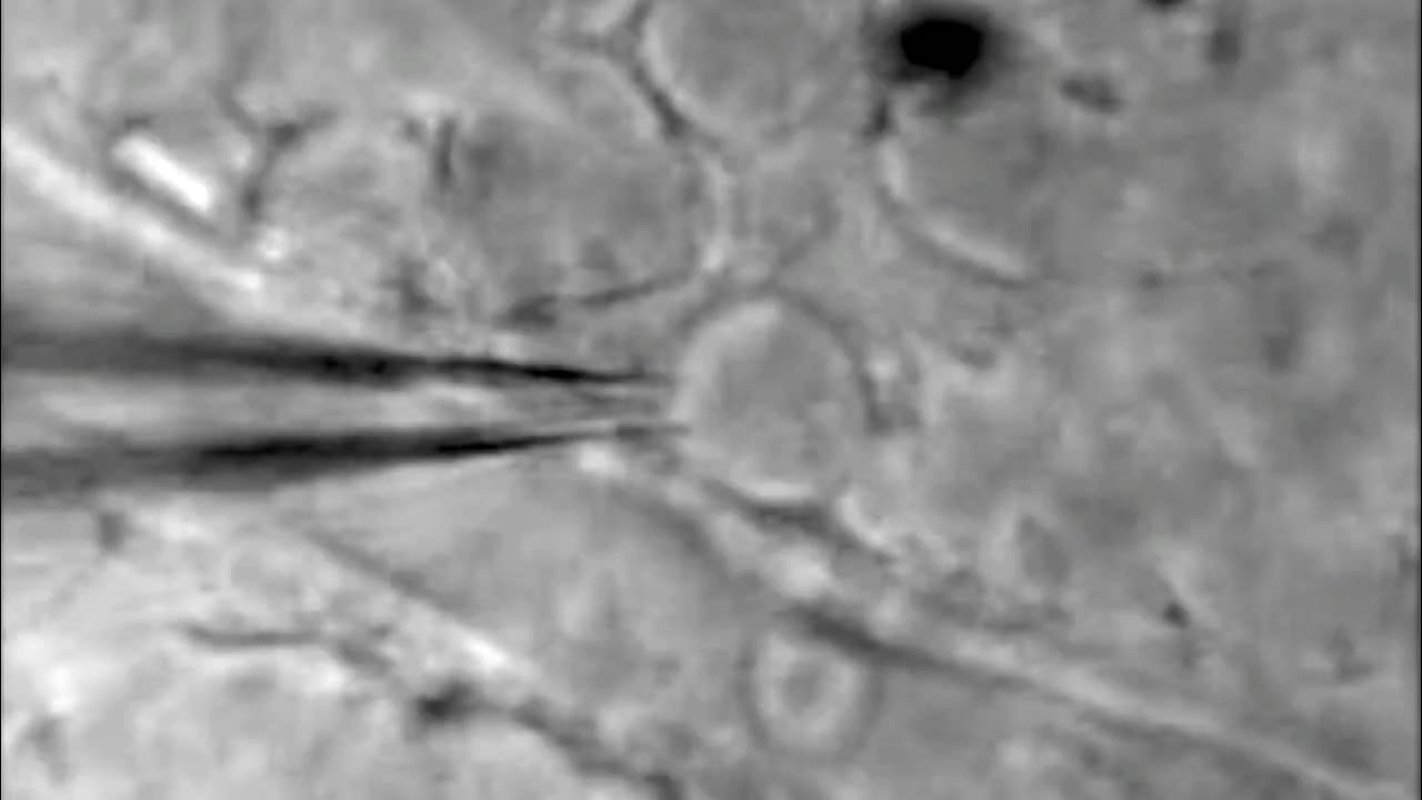 Cleaning the mouse retina for patch clamp recording