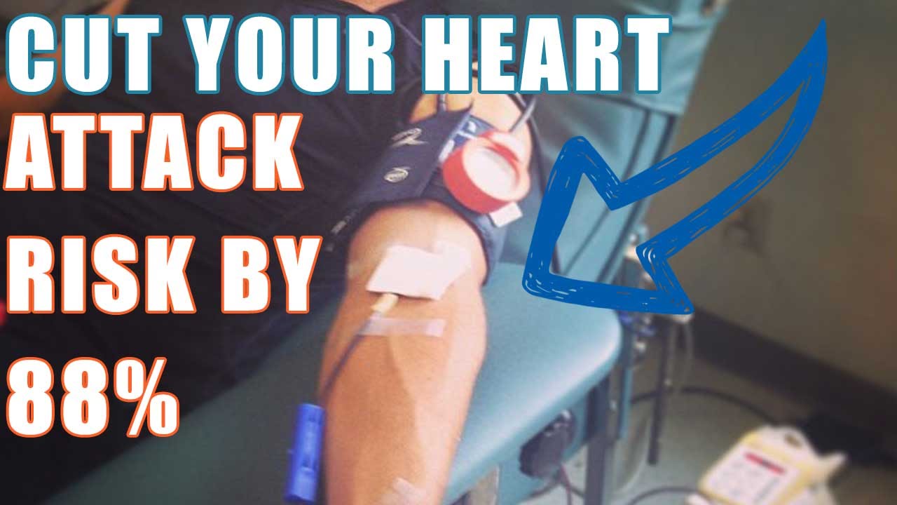 High Blood Pressure & blood viscosity and blood donation