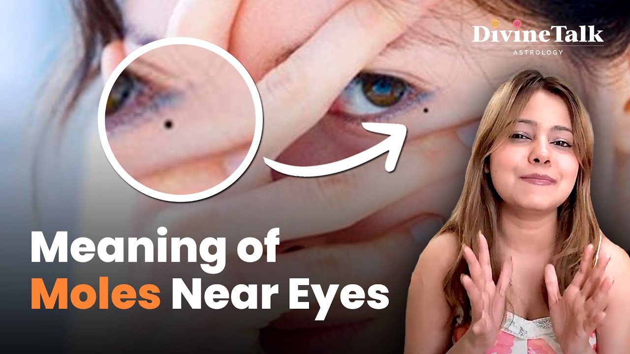 The Secret Meanings of Eye Moles: Unlocking Astrological Insights | DivineTalk Astrology