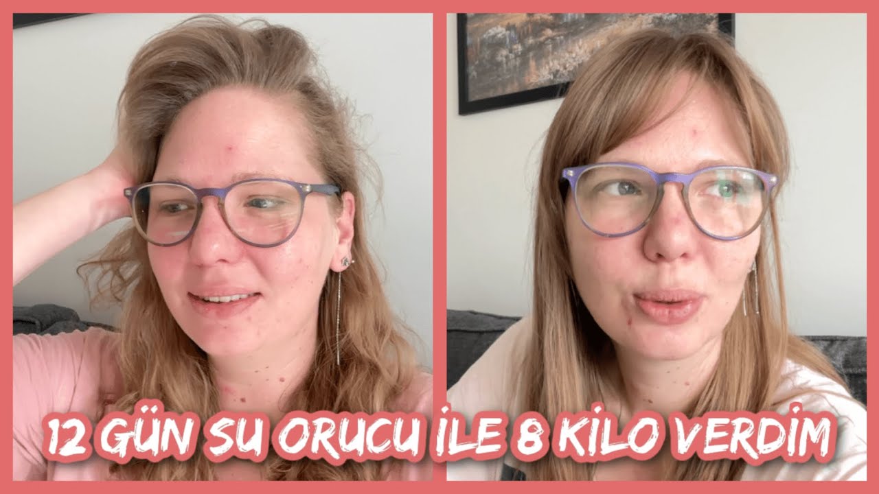 Su Orucu ile 12 Günde 8 Kilo Verdim 💦🥛  Omadla 8 Günde 4 Kilo Toplam 12 Kilo 💪🏻💪🏻💪🏻