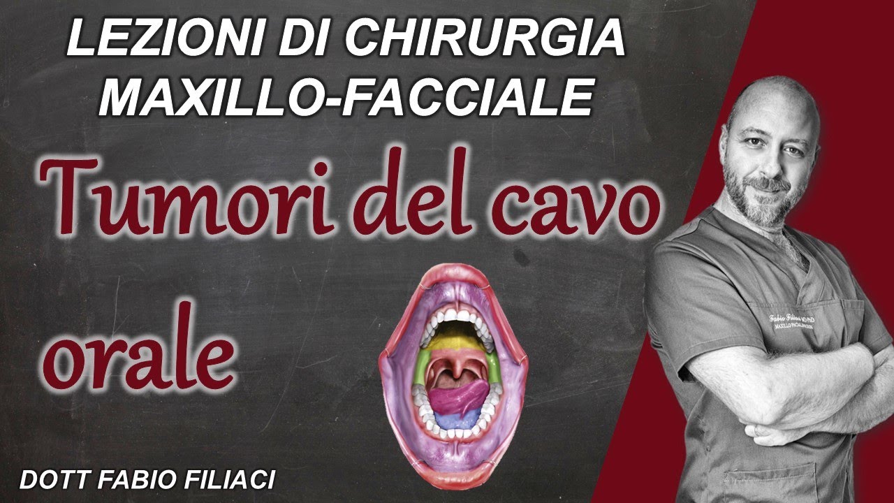 Lezioni di chirurgia maxillo facciale: I tumori del cavo orale