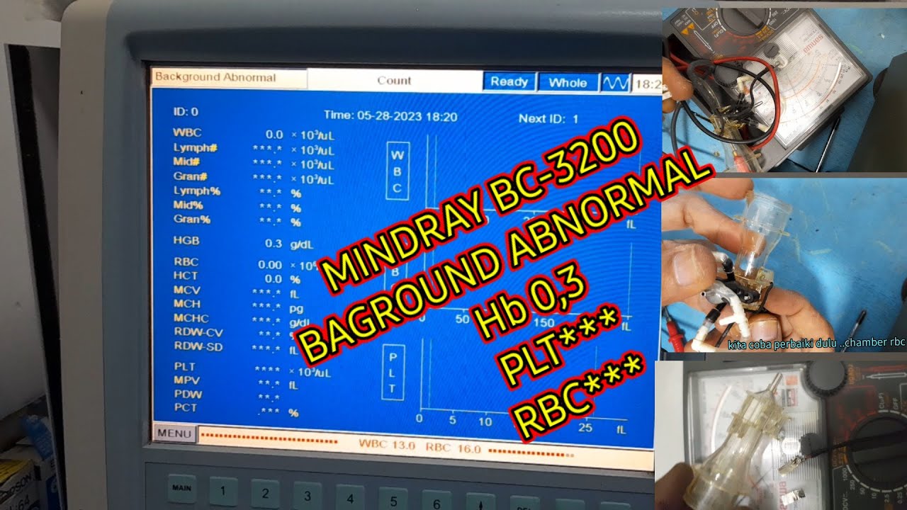 BAGROUND ABNORMAL MINDRAY BC-3200 #V76