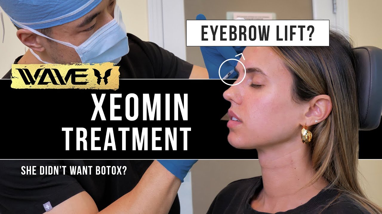 Getting a Non-Surgical Eyebrow Lift with Injections? Influencer tries Xeomin after YEARS of Botox