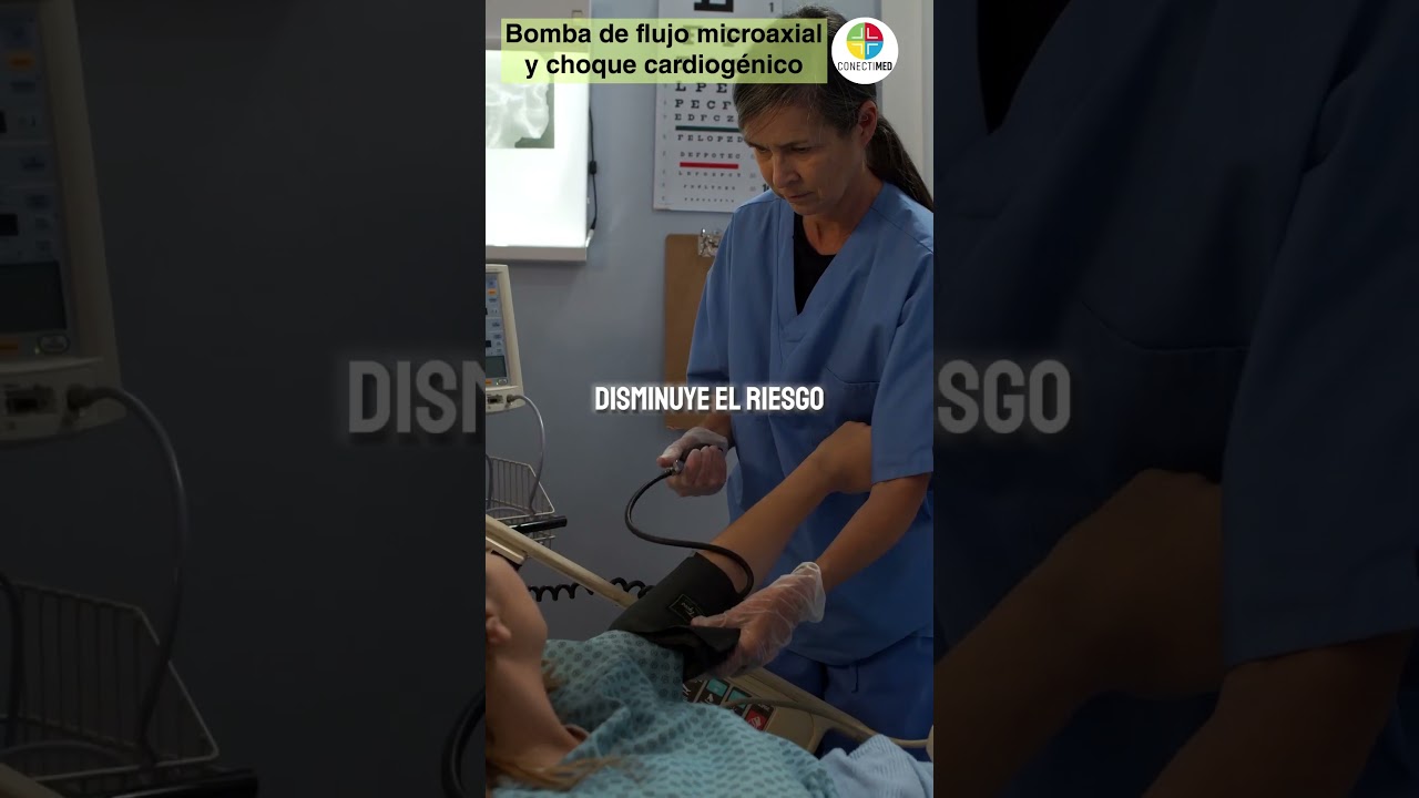 Bomba de flujo microaxial y choque cardiogénic 
