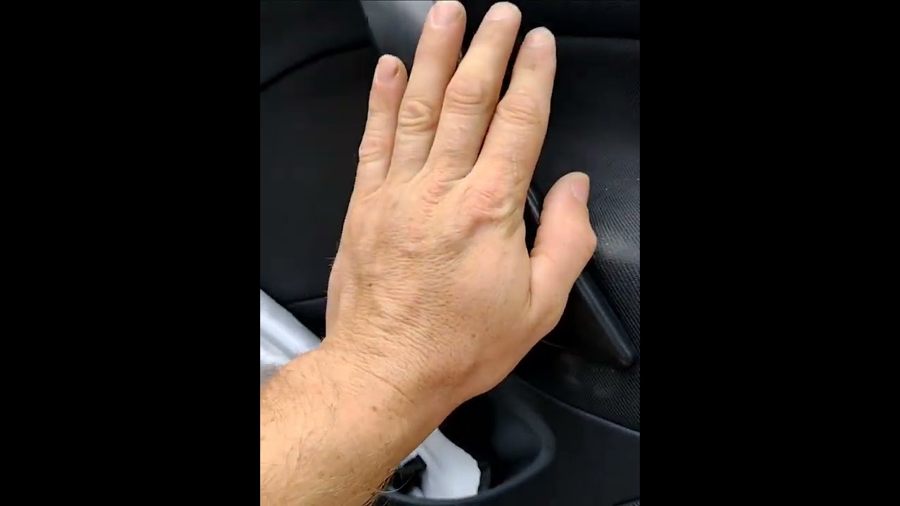 Octavia 2 ako demontovať tapacír dverý bez poškodenia .