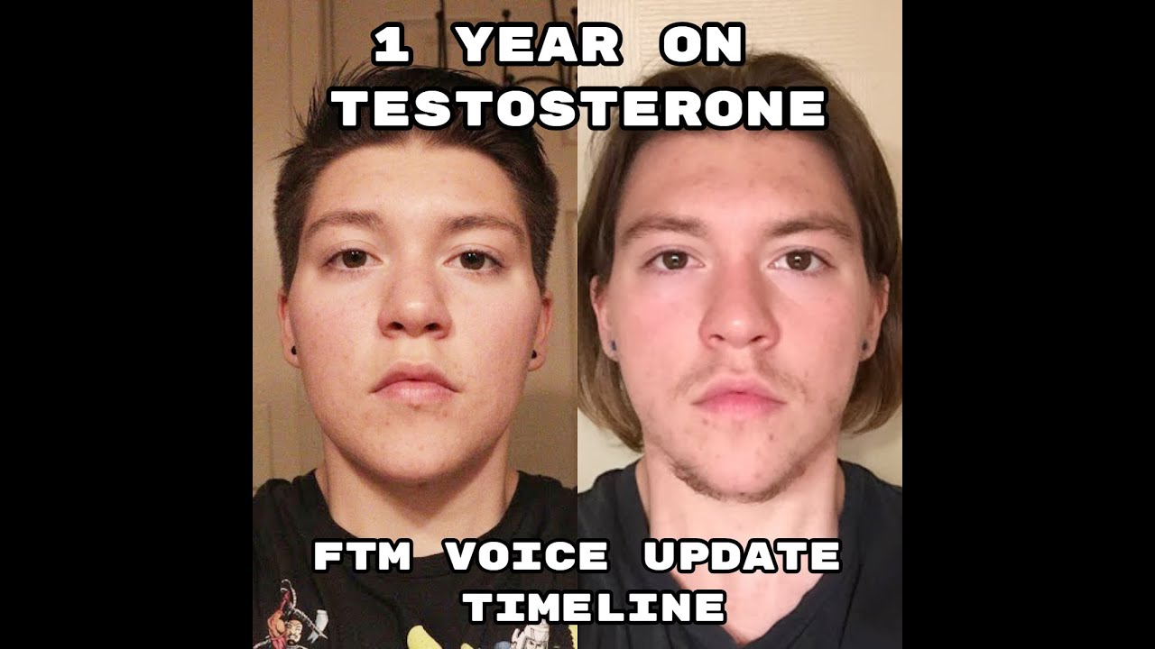 1 Year on T FTM Transgender Voice Update Timeline