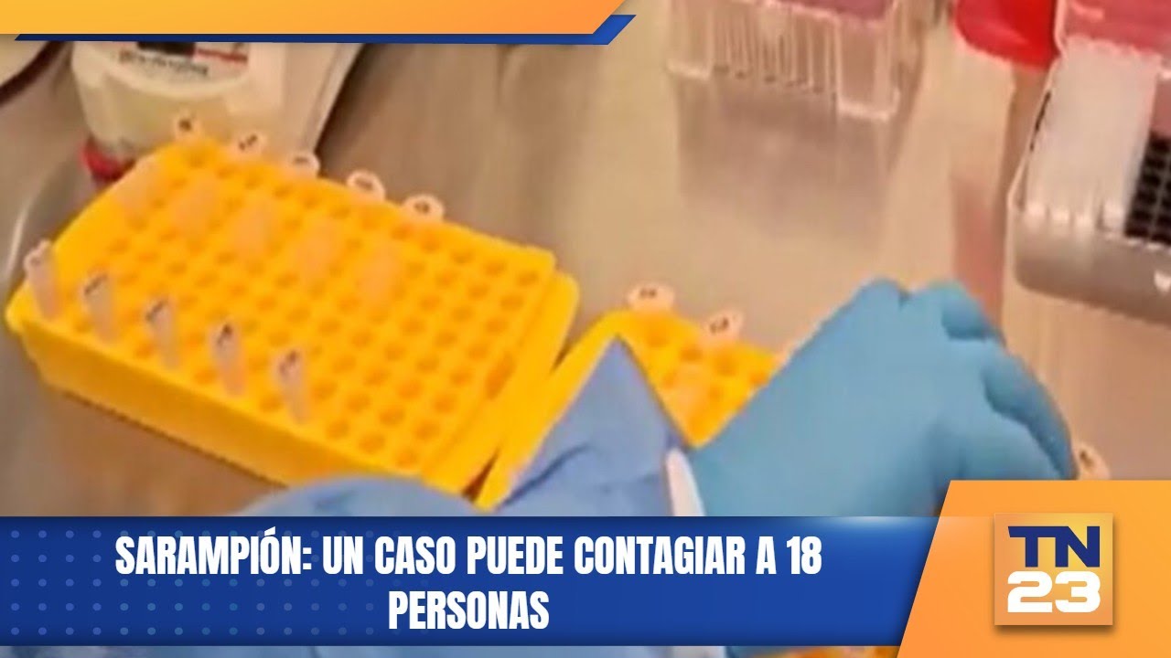 Sarampión: Un caso puede contagiar a 18 personas