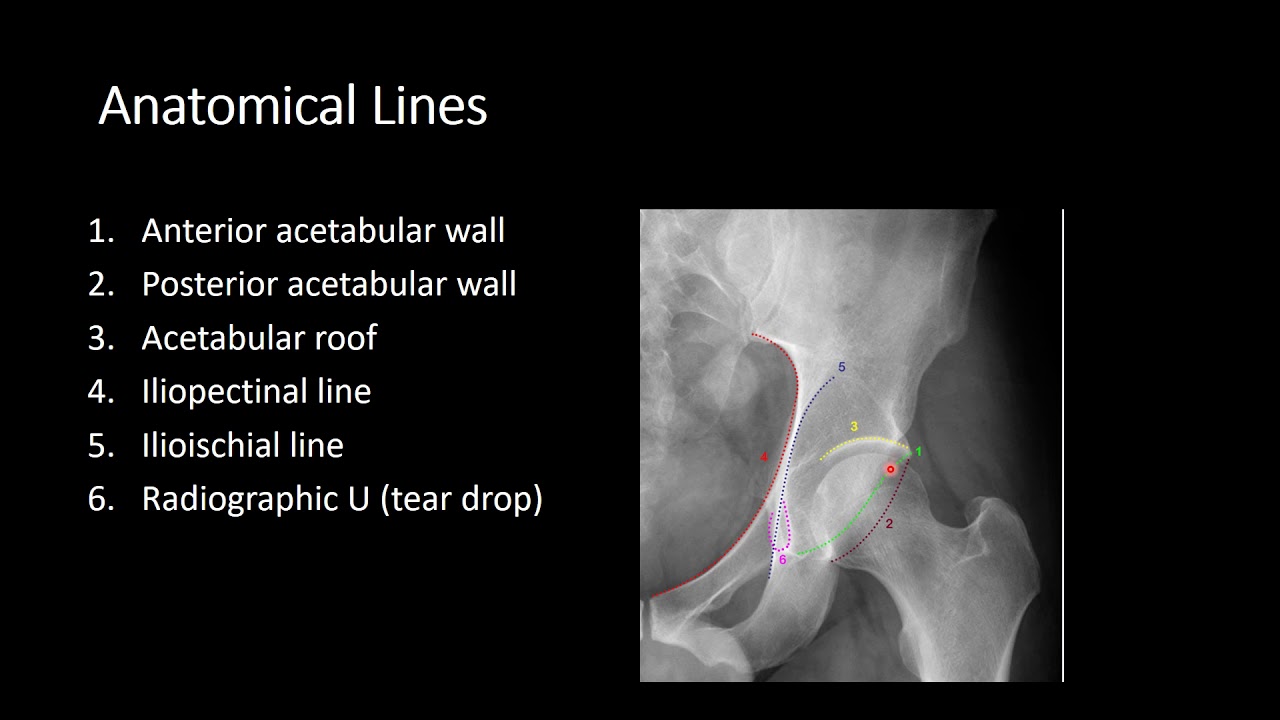 Pelvis & Hip  Part 1