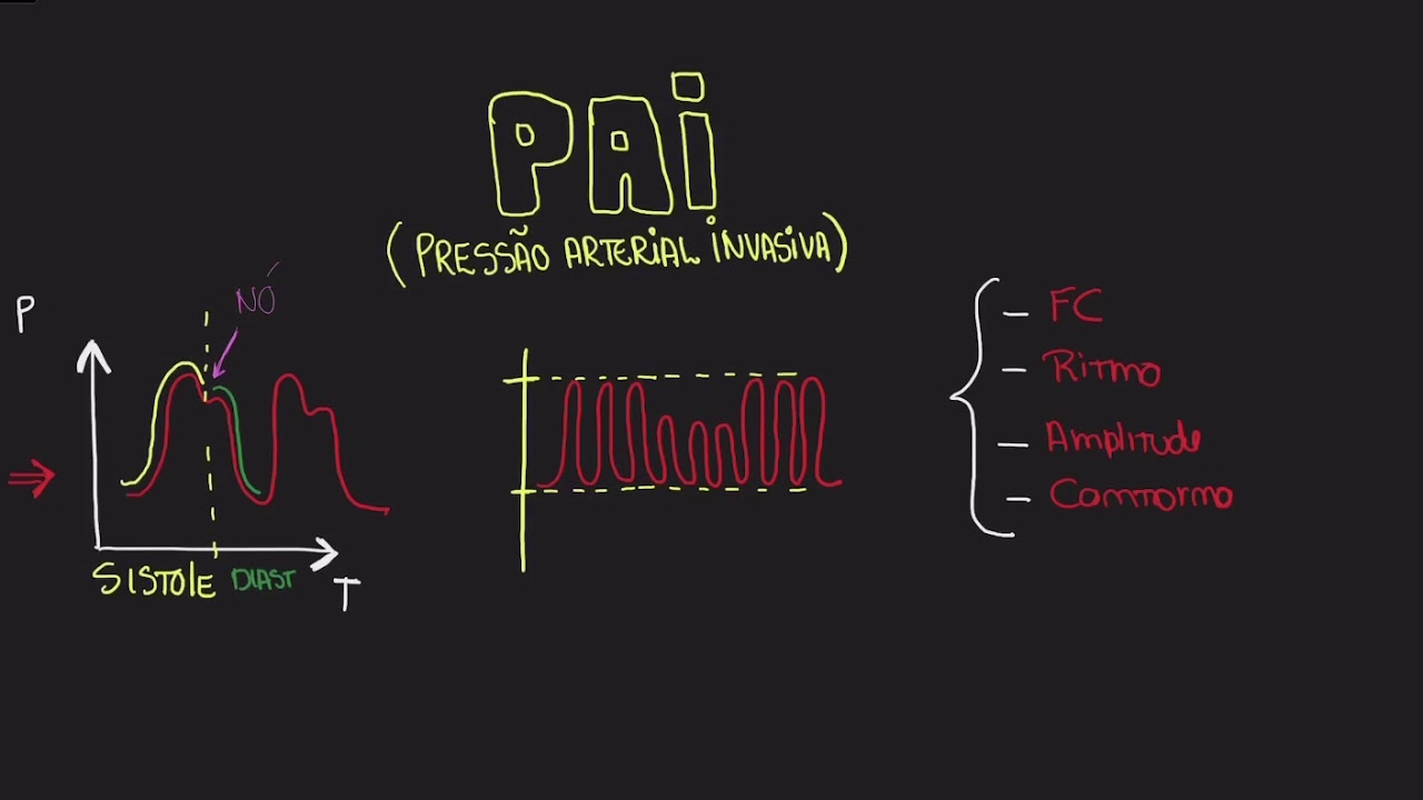 PRESS&Atilde;O ARTERIAL INVASIVA