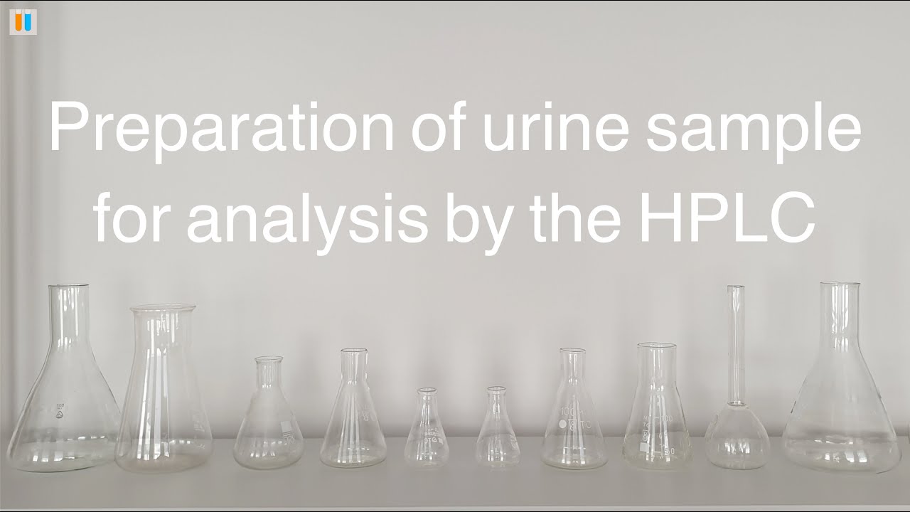 2.4 Preparation of urine sample for analysis by the HPLC
