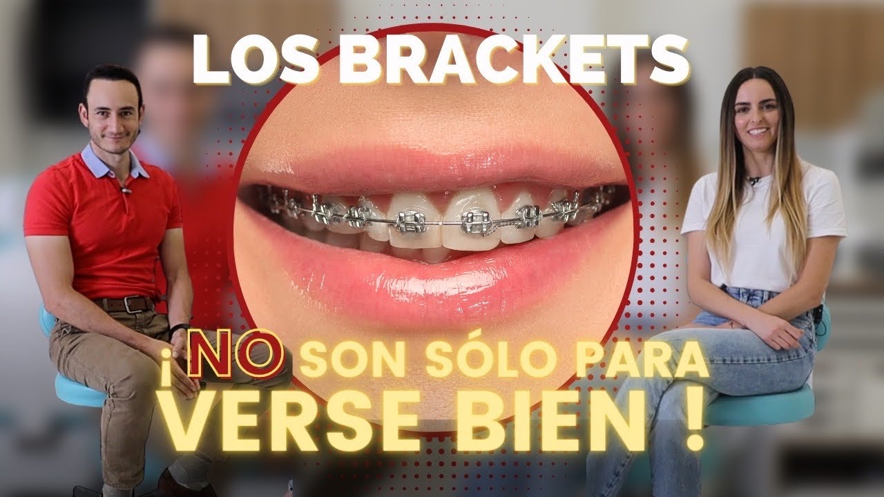 Pocos conocen estos increíbles beneficios de los Brackets 😲