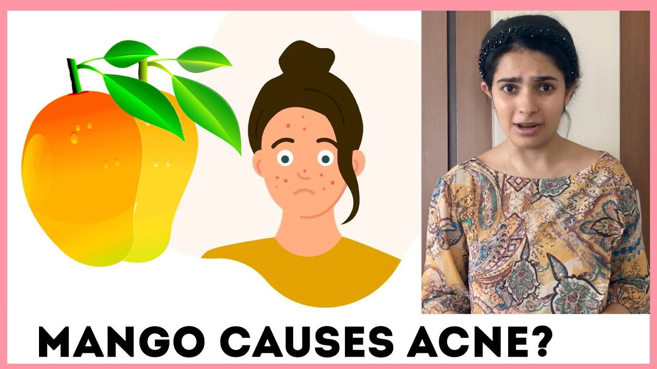 Does Mango Cause Acne? | Explained