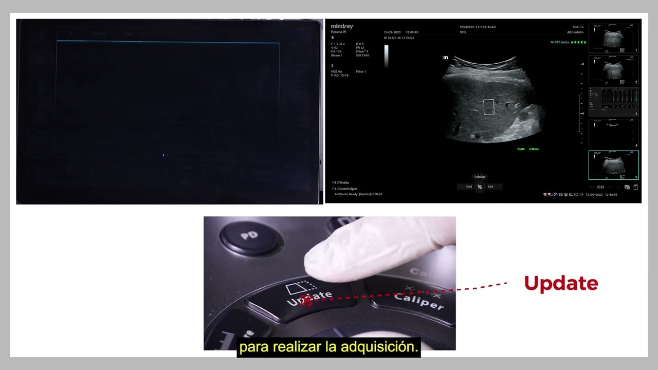 STQ Resona i9