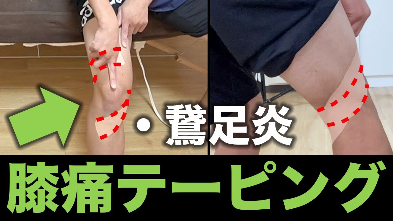 【ランニング 膝の痛み】自分で出来る鵞足炎テーピング方法【二子玉川　鍼灸整体院WATO】