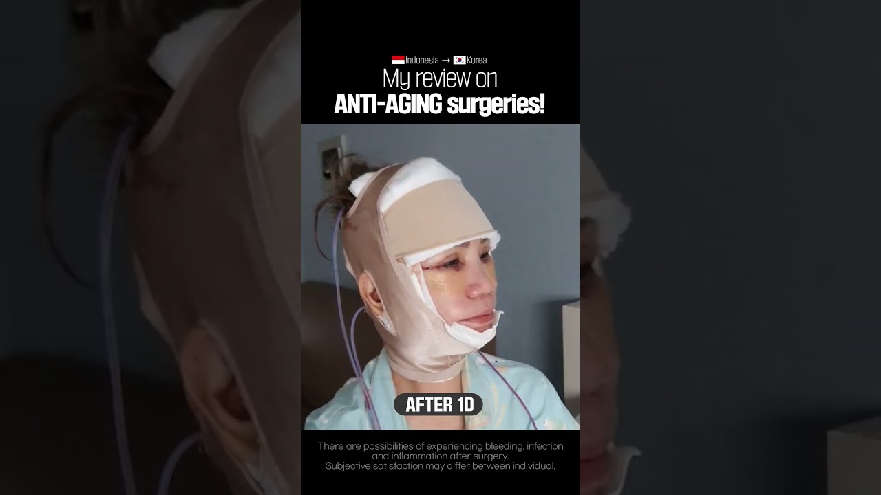 My facelift journey from Indonesia to Korea