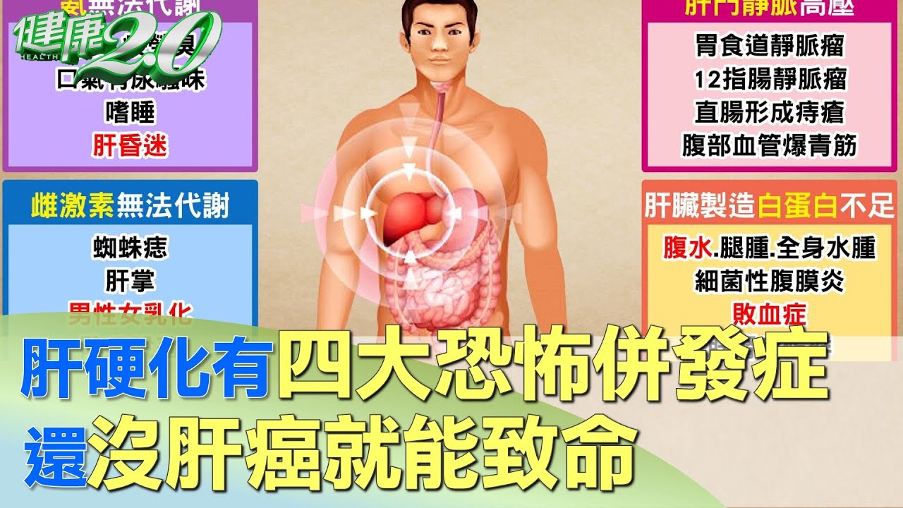 肝硬化有四大恐怖併發症 還沒肝癌就能致命 健康2.0