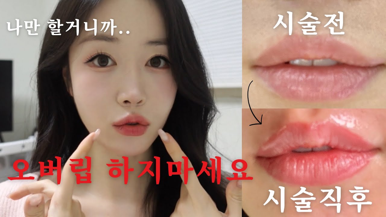 예약 대기만 3달?! 요즘 핫한 오버립 반영구 타투 드디어 받았는데 이것 주의하세요..