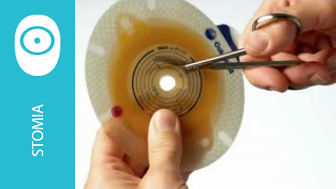 Come preparare e ritagliare il dispositivo per stomia due pezzi