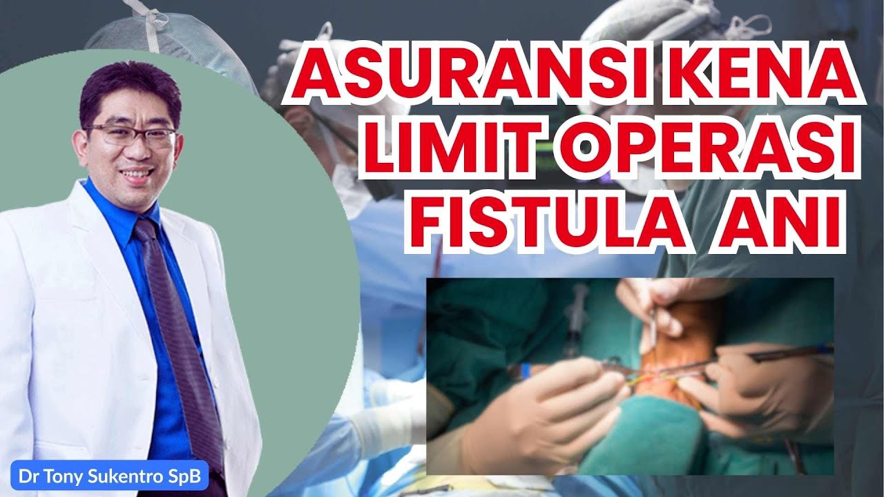 ASURANSI KENA LIMIT ! TENANG OPERASI FISTULA ANI BISA LANCAR DENGAN INI... 