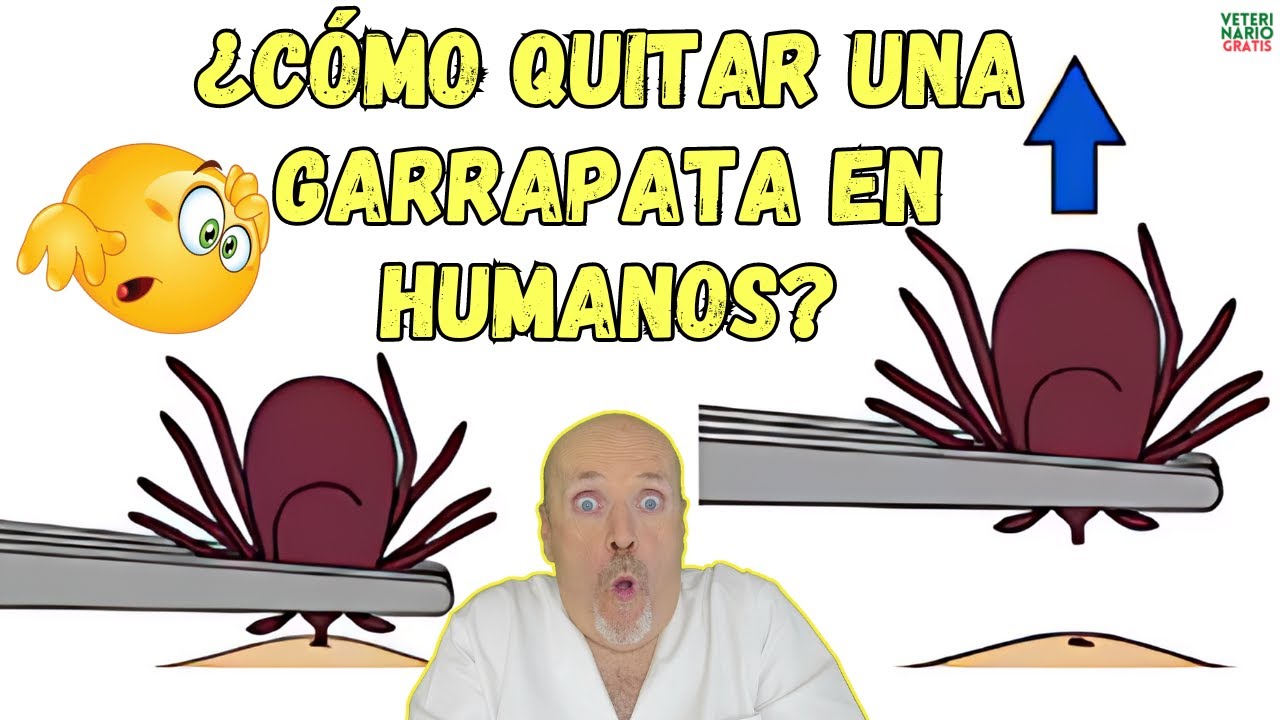 🆘 ¿CÓMO QUITAR UNA GARRAPATA EN HUMANOS Y ELIMINARLA DESPUÉS? 🆘