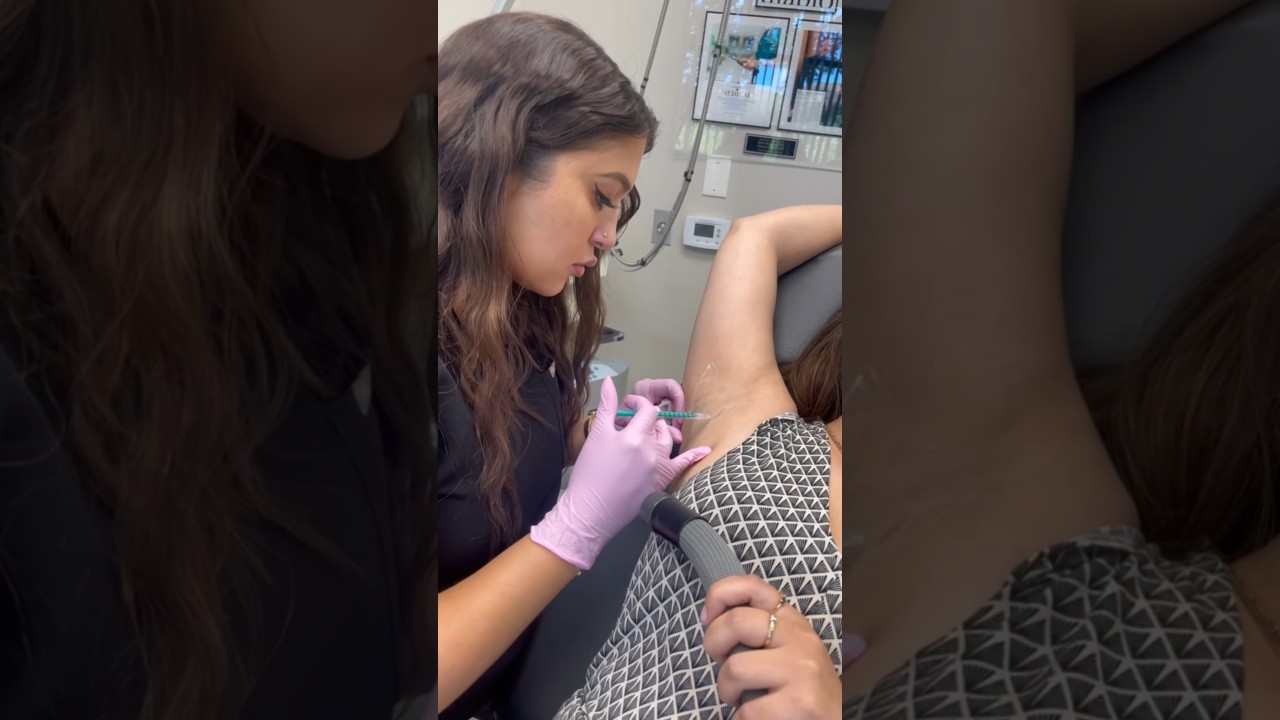 Stop excessive sweating with Botox in the underarms 💉