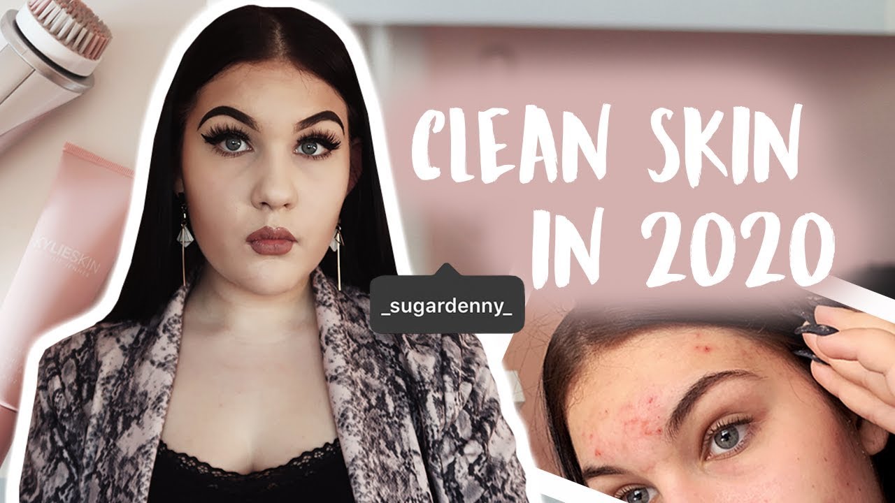 watch for a clean skin | JAK JSEM SE ZBAVILA AKNÉ | SugarDenny