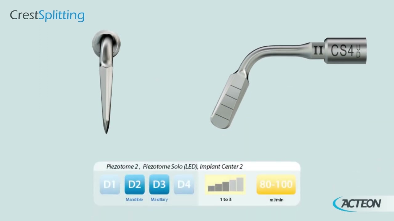 TUTORIAL Crest Splitting 3D 2023 - Surgery tips - Equipment - Acteon Group