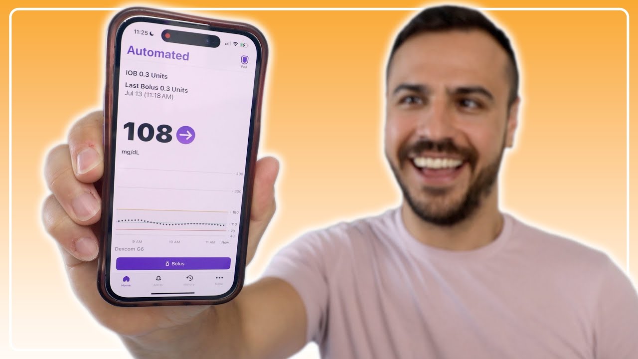 Omnipod 5 iPhone App Explained