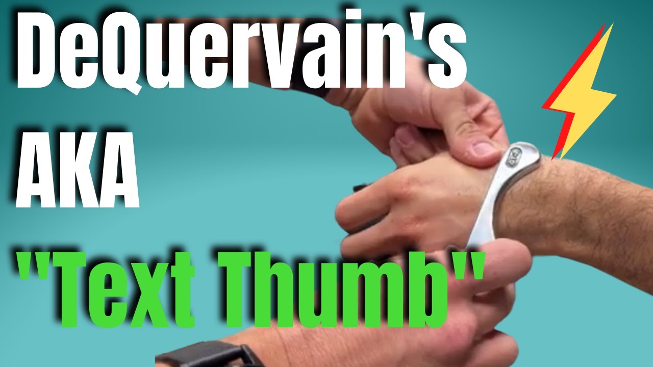 De Quervain's Tenosynovitis | San Diego Chiropractic