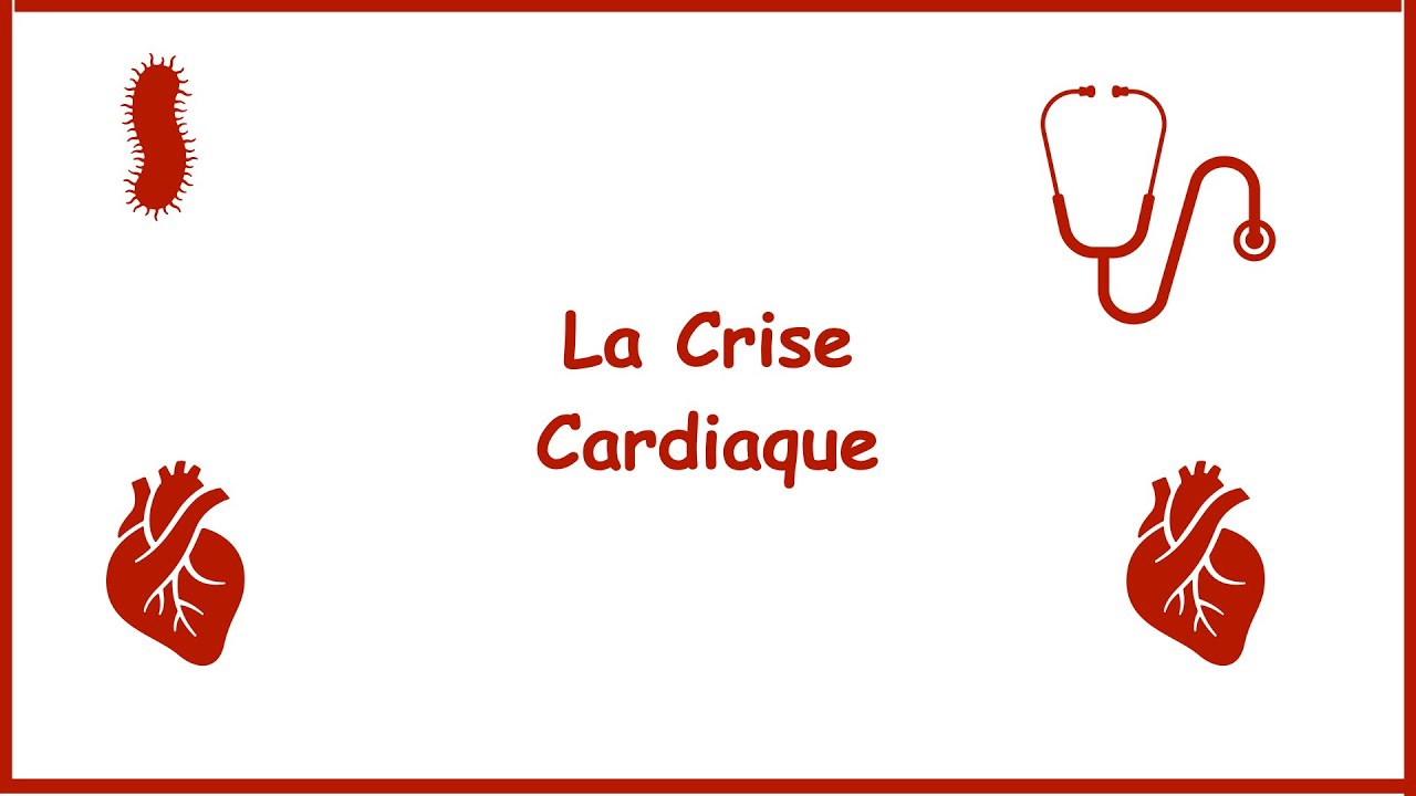 Crise cardiaque (infarctus aigu du myocarde) - causes, symptômes, diagnostic, traitement, pathologie