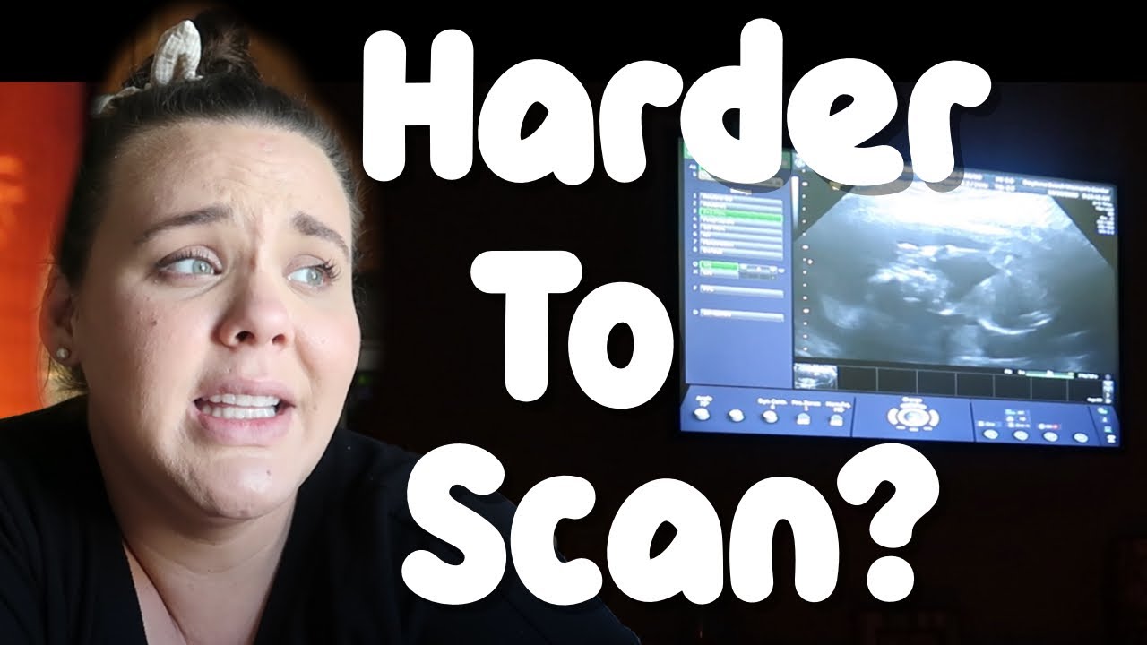 20 Week Ultrasound Plus Size And Pregnant