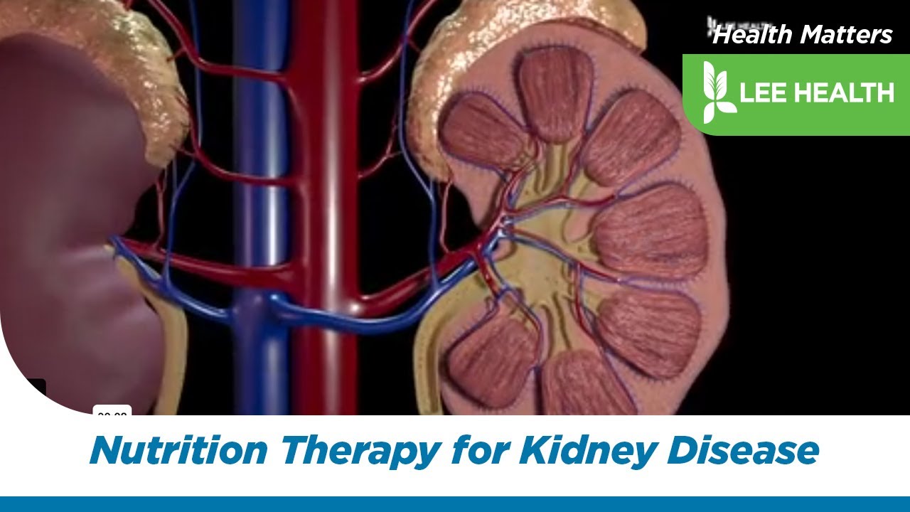 Medical Nutrition Therapy for Chronic Kidney Disease
