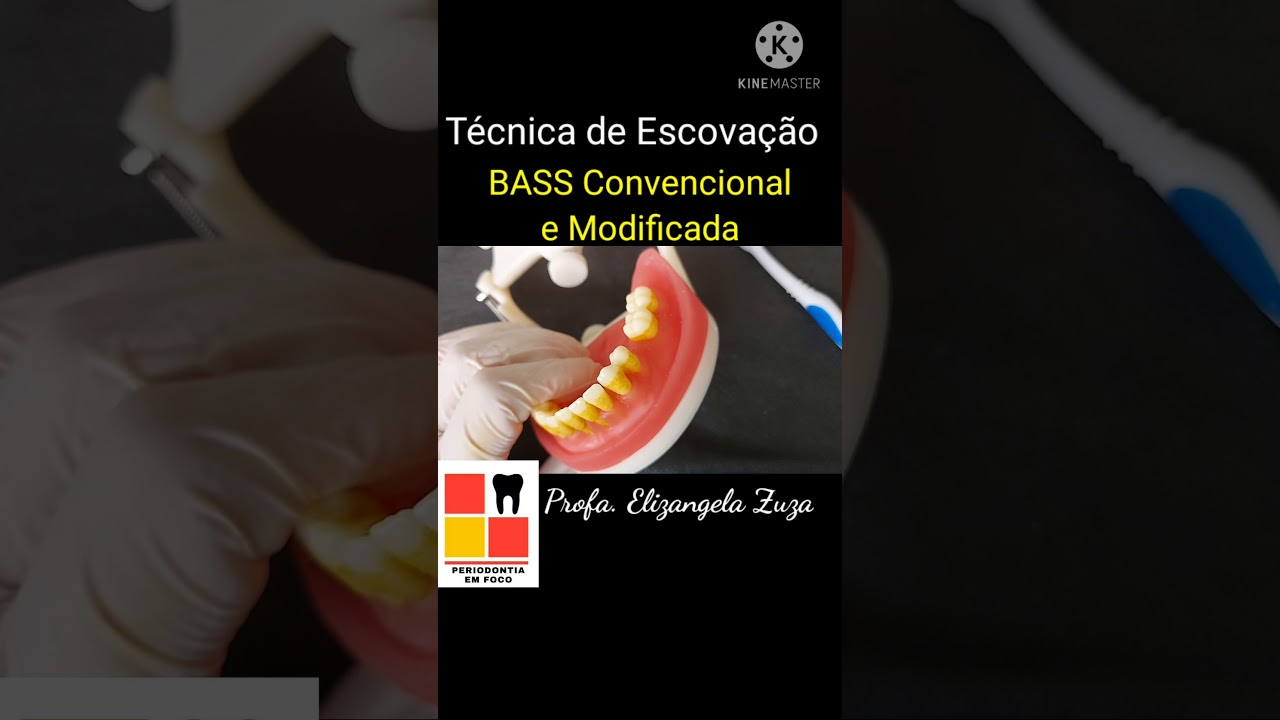 TÉCNICA DE BASS CONVENCIONAL VS. MODIFICADA