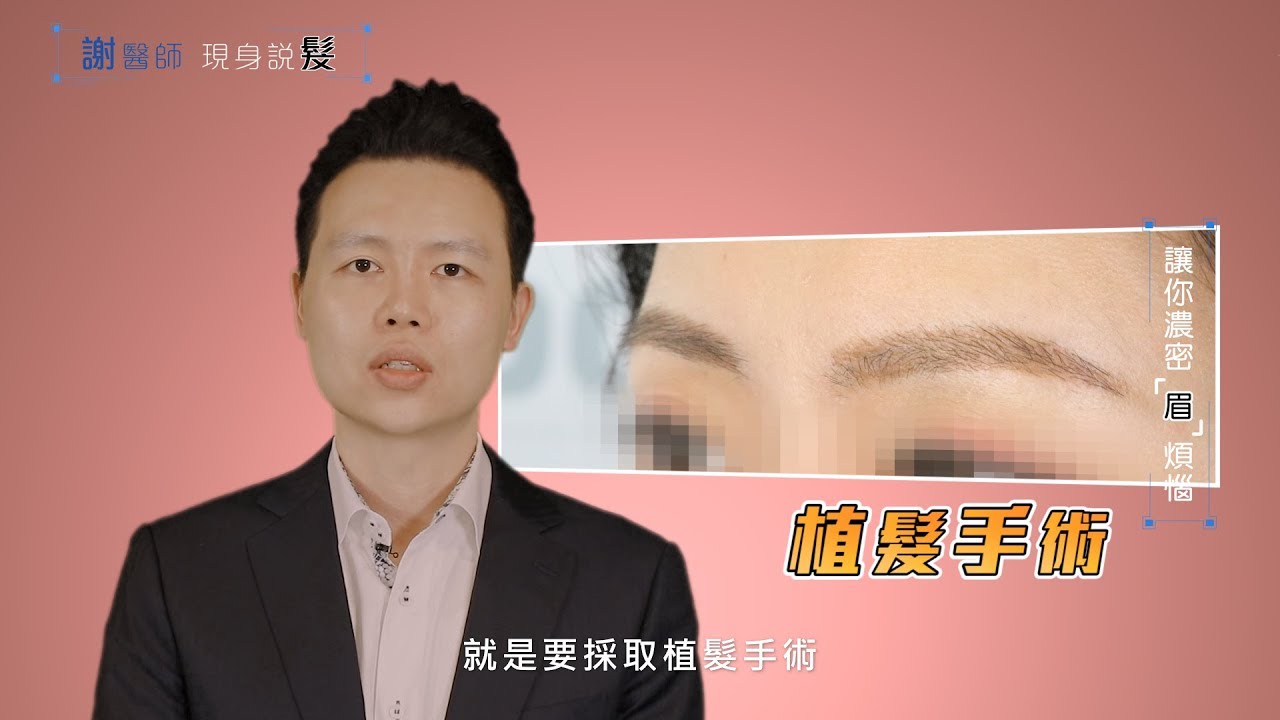 【植眉手術】謝宗廷醫師告訴你好看眉型怎麼做