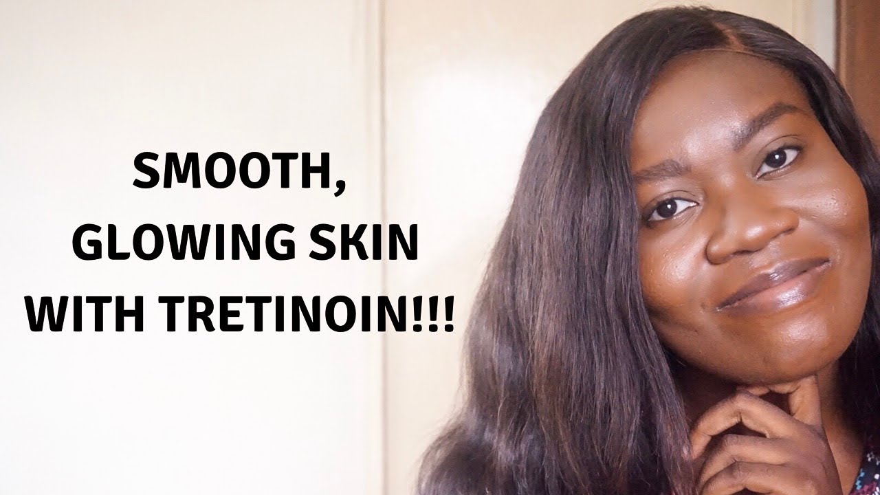 GET THE BEST OF YOUR RETIN-A CREAM WITH THESE TIPS | SHE IS NATURALLY BRONZE
