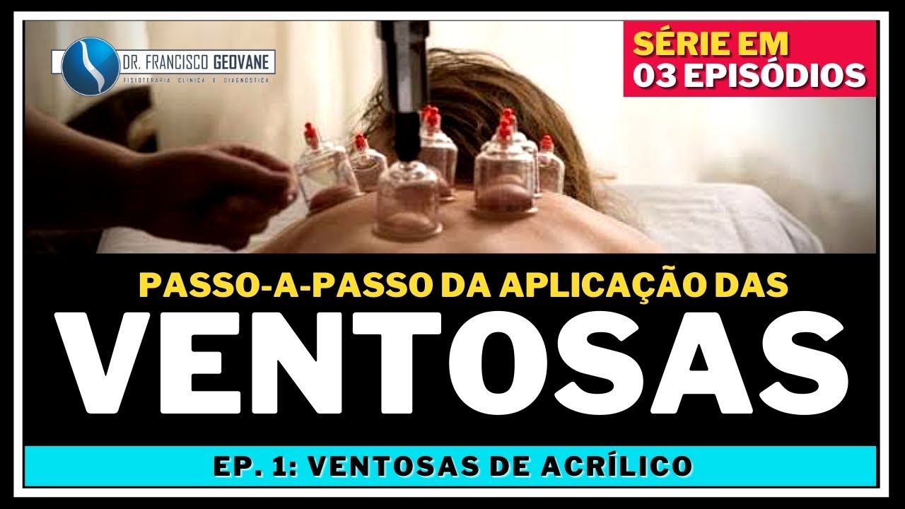 VENTOSATERAPIA - PASSO-A-PASSO para Aplicar as Ventosas de Acrílico (AULA 1/3)