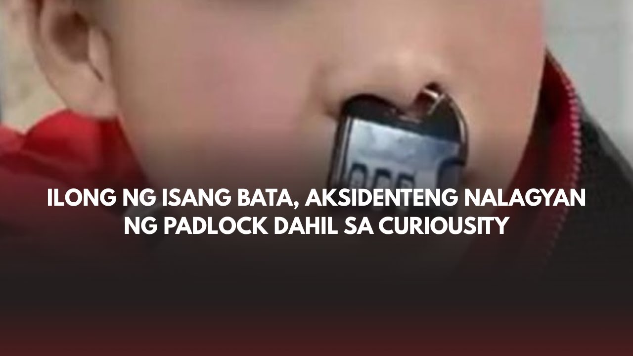 Ilong ng isang bata, aksidenteng nalagyan ng padlock dahil sa curiousity!