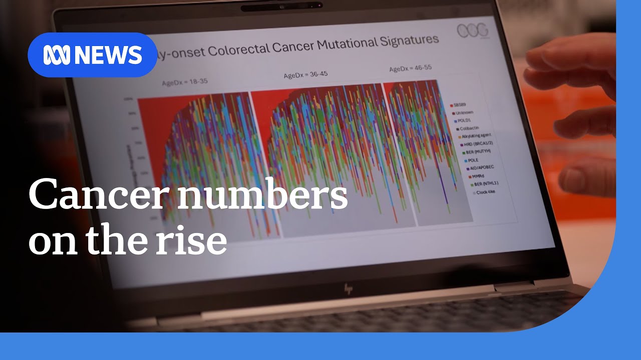 Cancer rates in Australians under 50 are rising | ABC NEWS