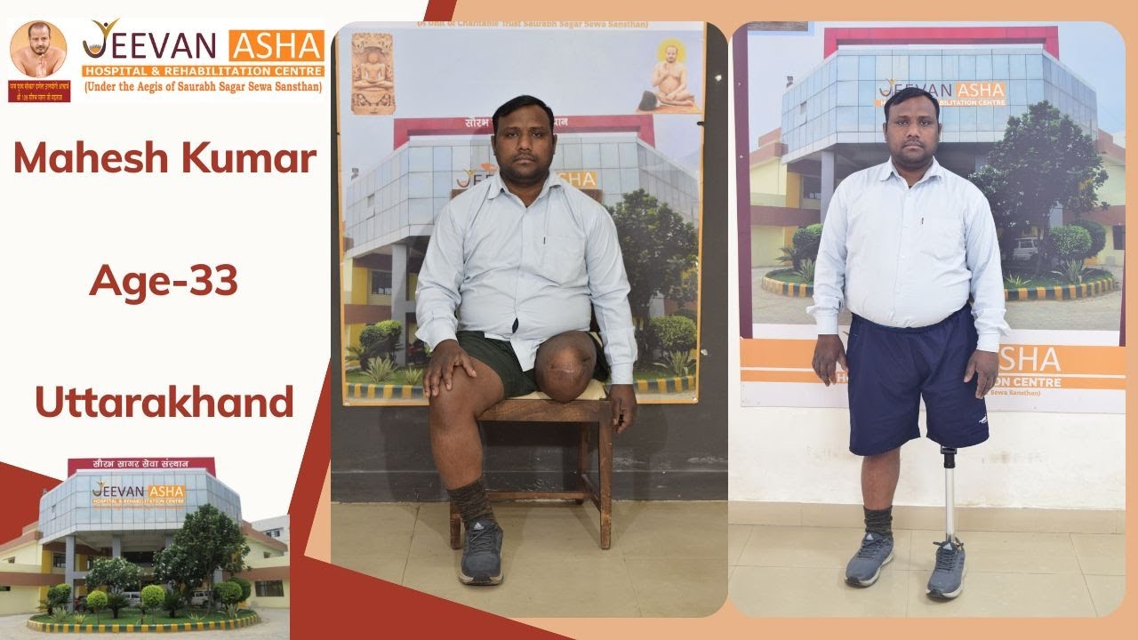 Mahesh lost left leg in a accident Jeevan Asha Hospital provided free of cost #modular #prosthesis