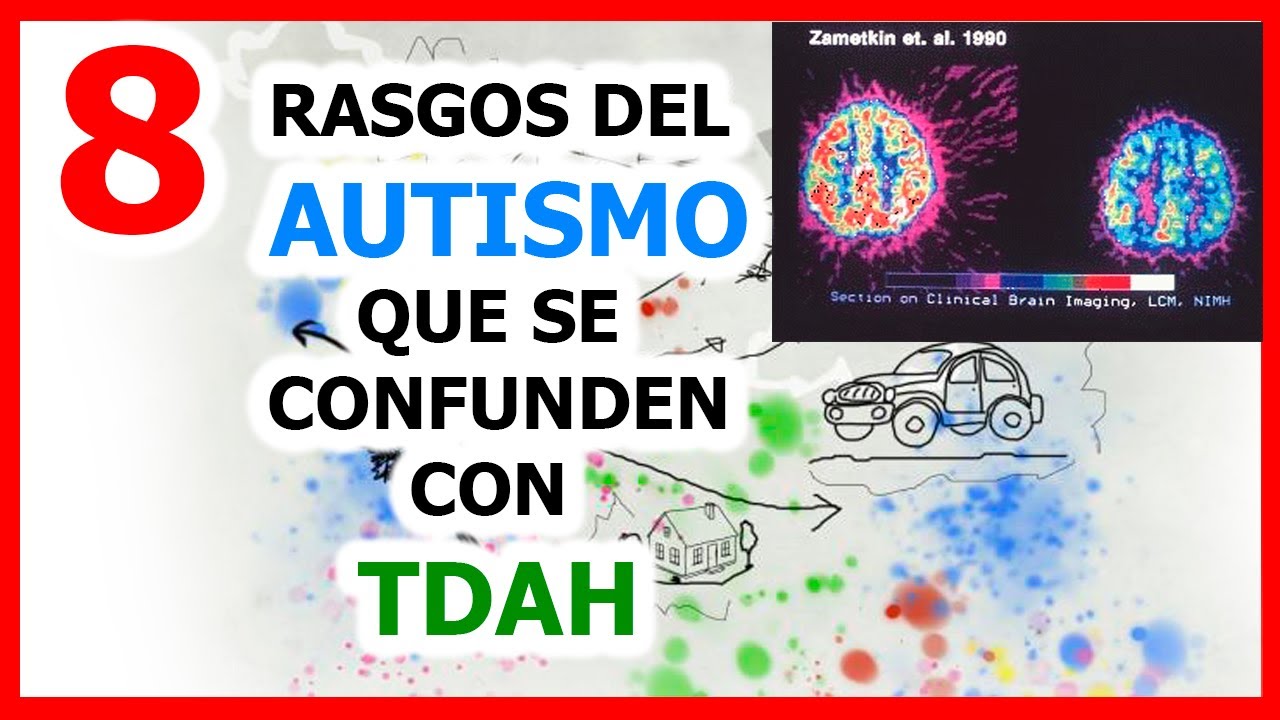 8 RASGOS DE AUTISMO QUE SE CONFUNDEN CON TDAH.