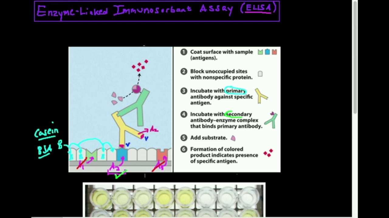 Antibodies/Antigens: ELISA Theory