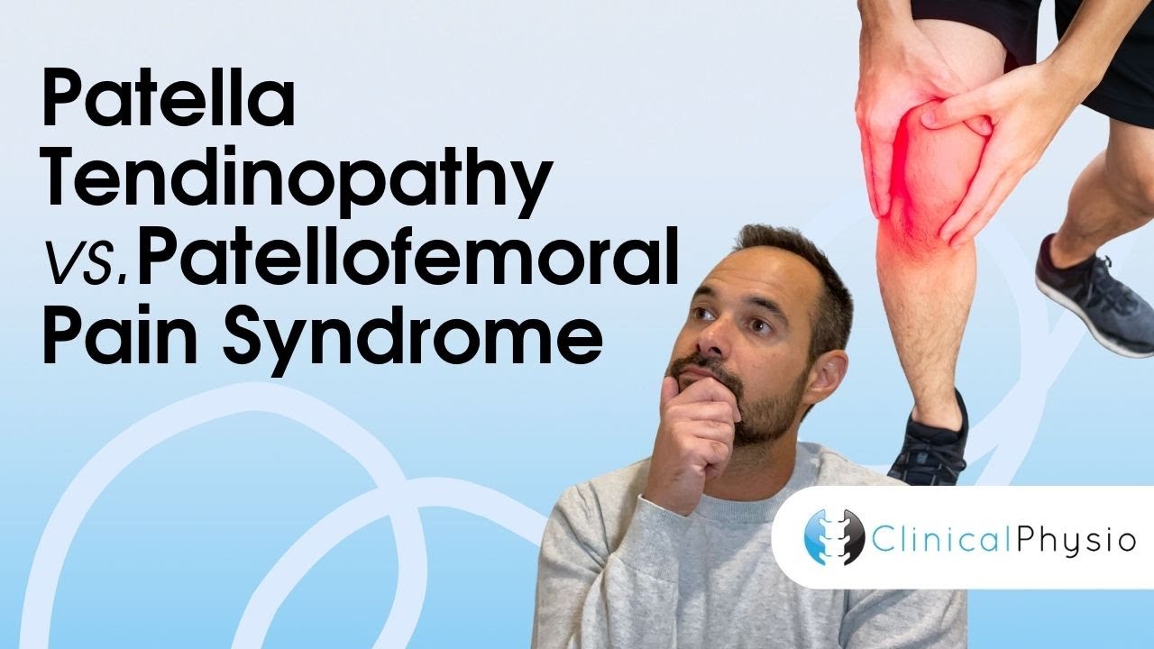 Patella Tendinopathy vs. Patellofemoral Pain Syndrome | Expert Physio Guide