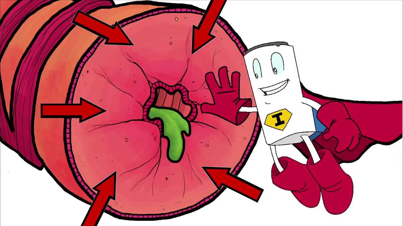 What is Asthma? - for Kids with Asthma
