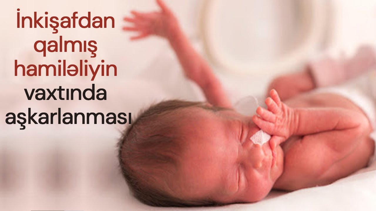 İnkişafdan qalmış hamiləliyin vaxtında aşkarlanması - Cərrah mama ginekoloq Aynurə Nəcəfəliyeva