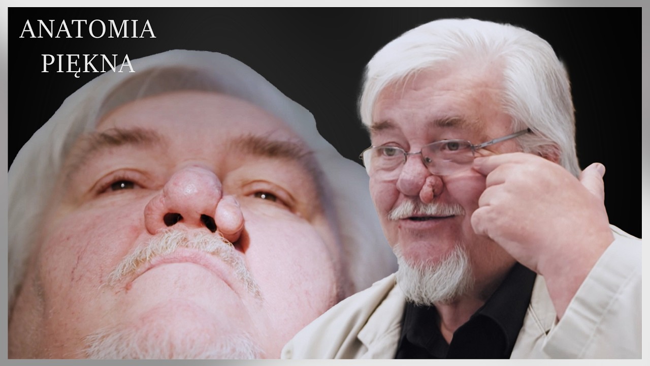 CZUJE SIĘ ŹLE ZE SWOIM 