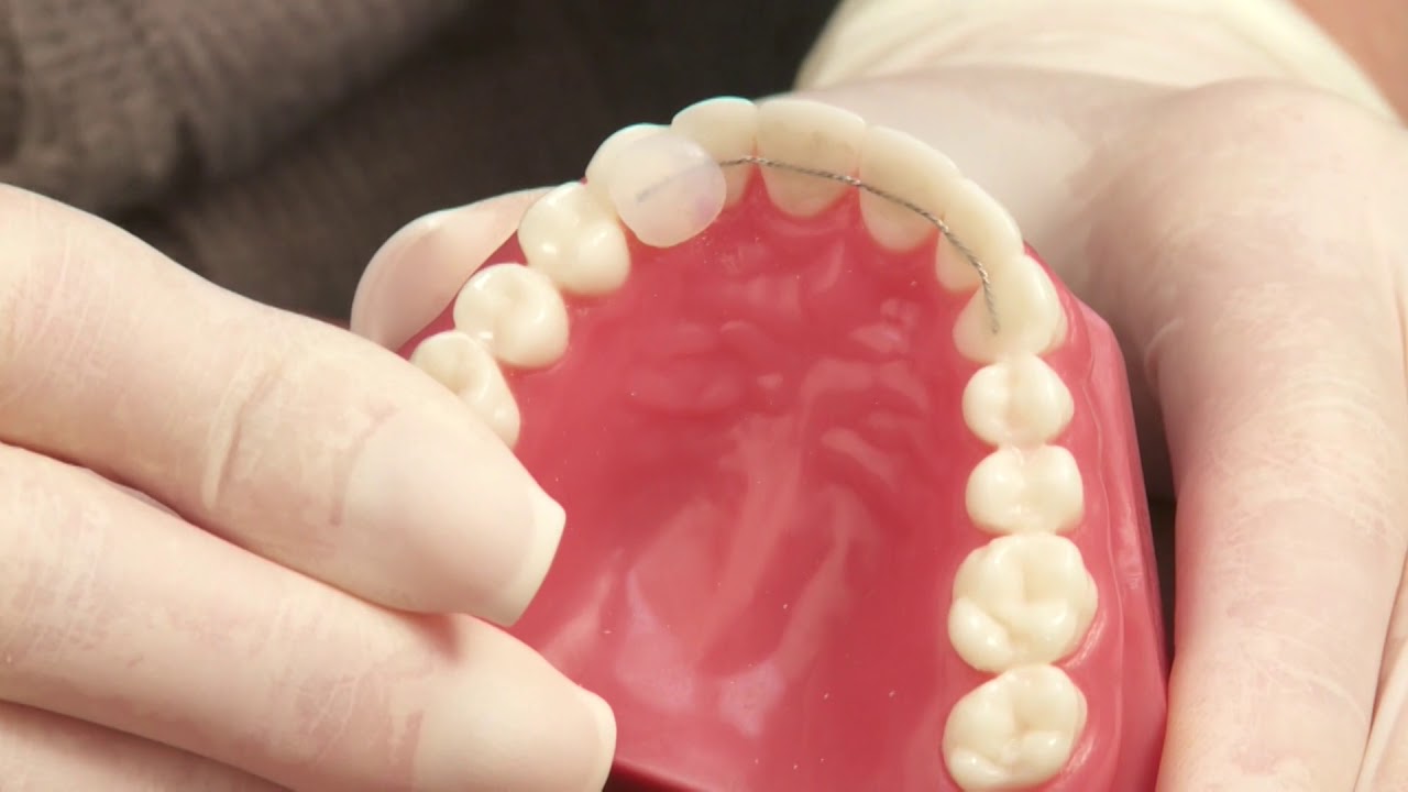 Retainers Care Instructions at Hidden Braces Boutique